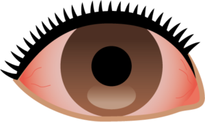 目が傷ついてしまう